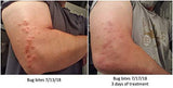 Bootlegged Phase I Healing Hemp Oil Concentrate for New Tattoos and other Acute Skin Conditions